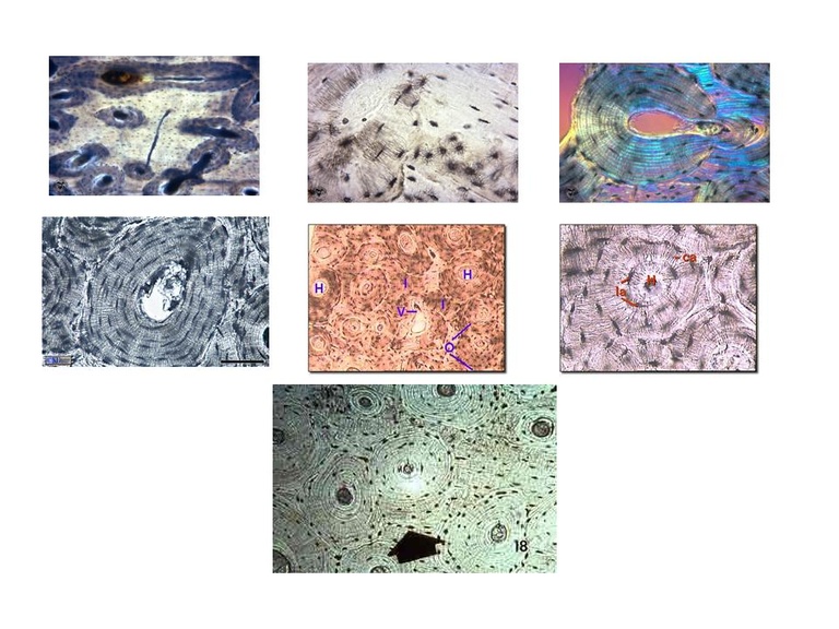 Cross-sectional pictures of osteons with lacunae and canaliculi 