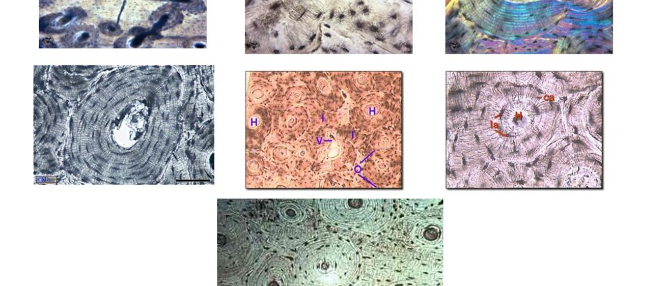 Cross-sectional pictures of osteons with lacunae and canaliculi 